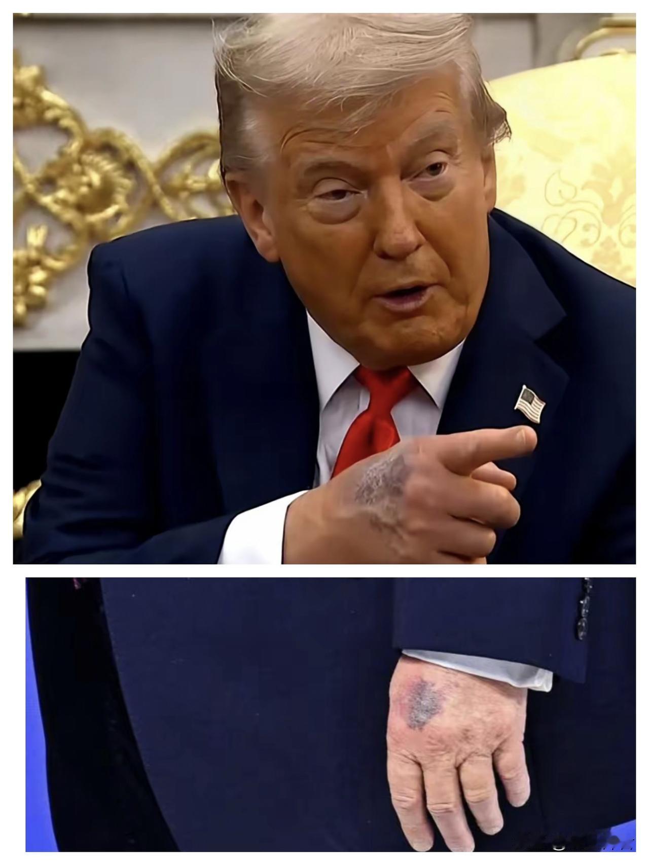 特朗普今年要迎来80大寿，不过看特朗普这手是不是有什么不好的征兆呀?亿万富翁特