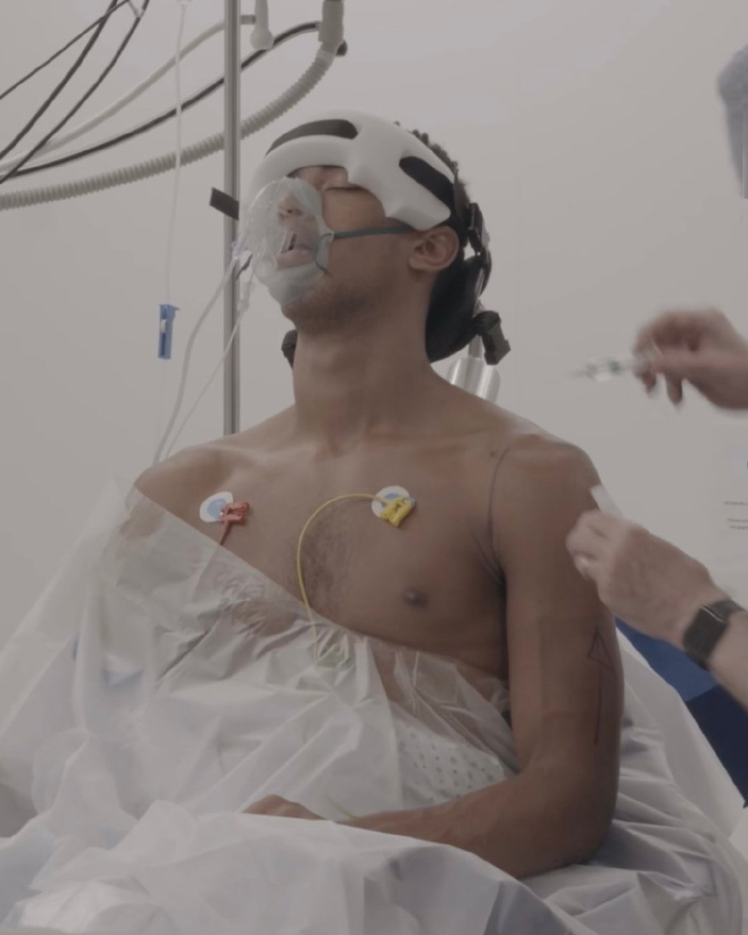 贝林厄姆的肩部手术过程