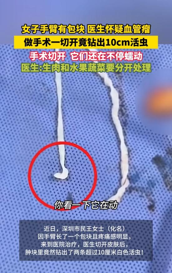 “头皮发麻！”6月14日报道，广东深圳，一女子手臂长了个包块，虽然不是很大，但却