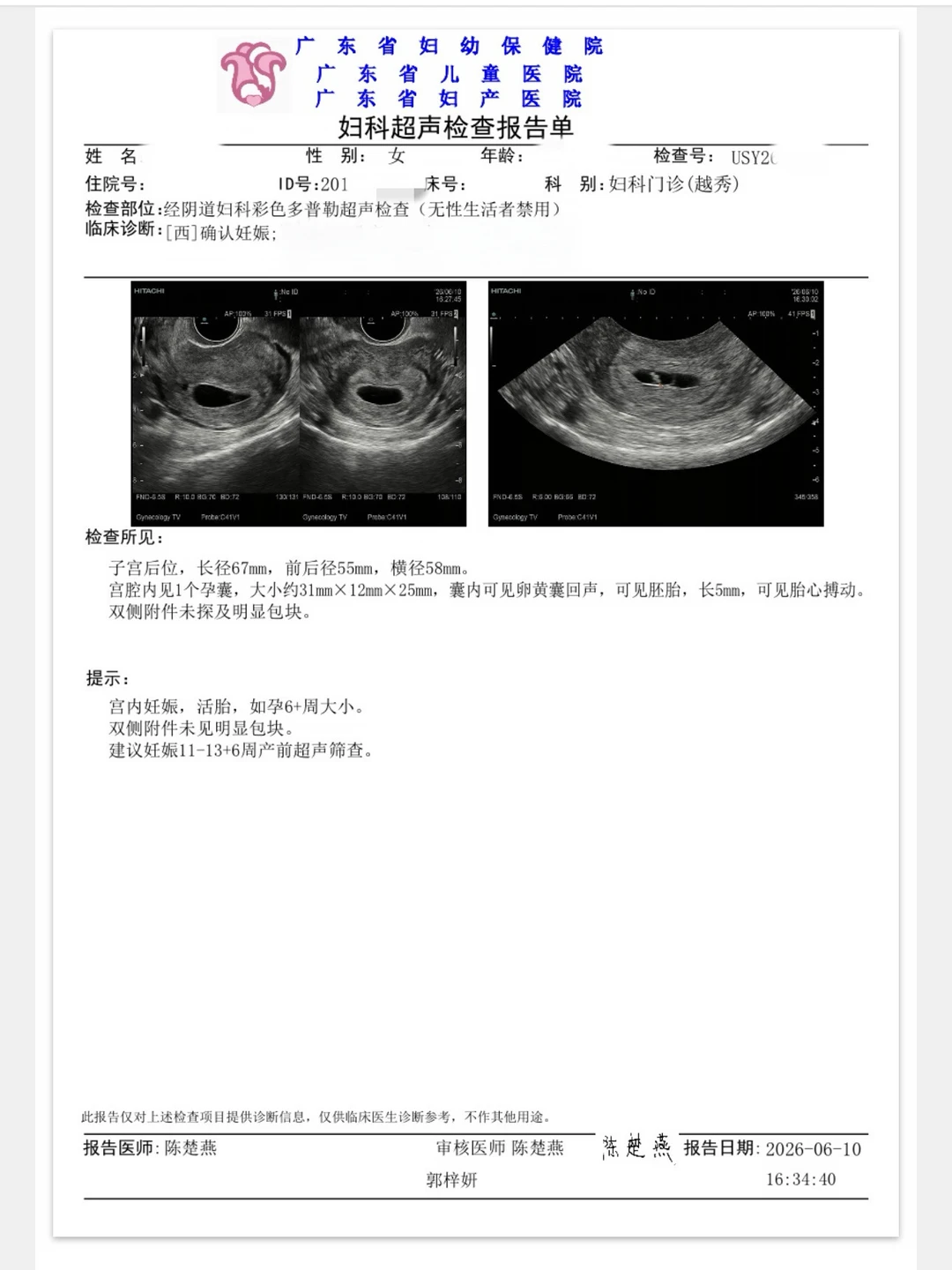 我能看到你的勇敢 宝宝