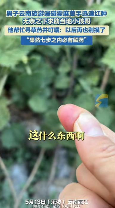 “这个小孩哥火了！”云南丽江，一男子去旅游误碰霍麻草，手迅速的红肿疼痛，无奈之下