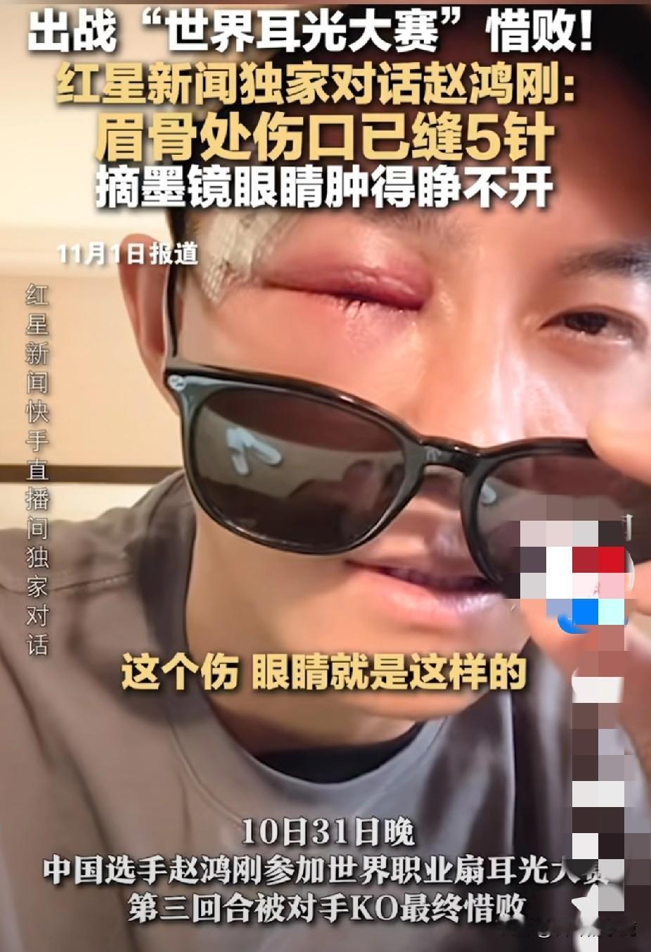 这哪是竞技？分明是拿命博眼球的尴尬！通背拳传人赵鸿刚硬扛三巴掌被KO，眉骨缝