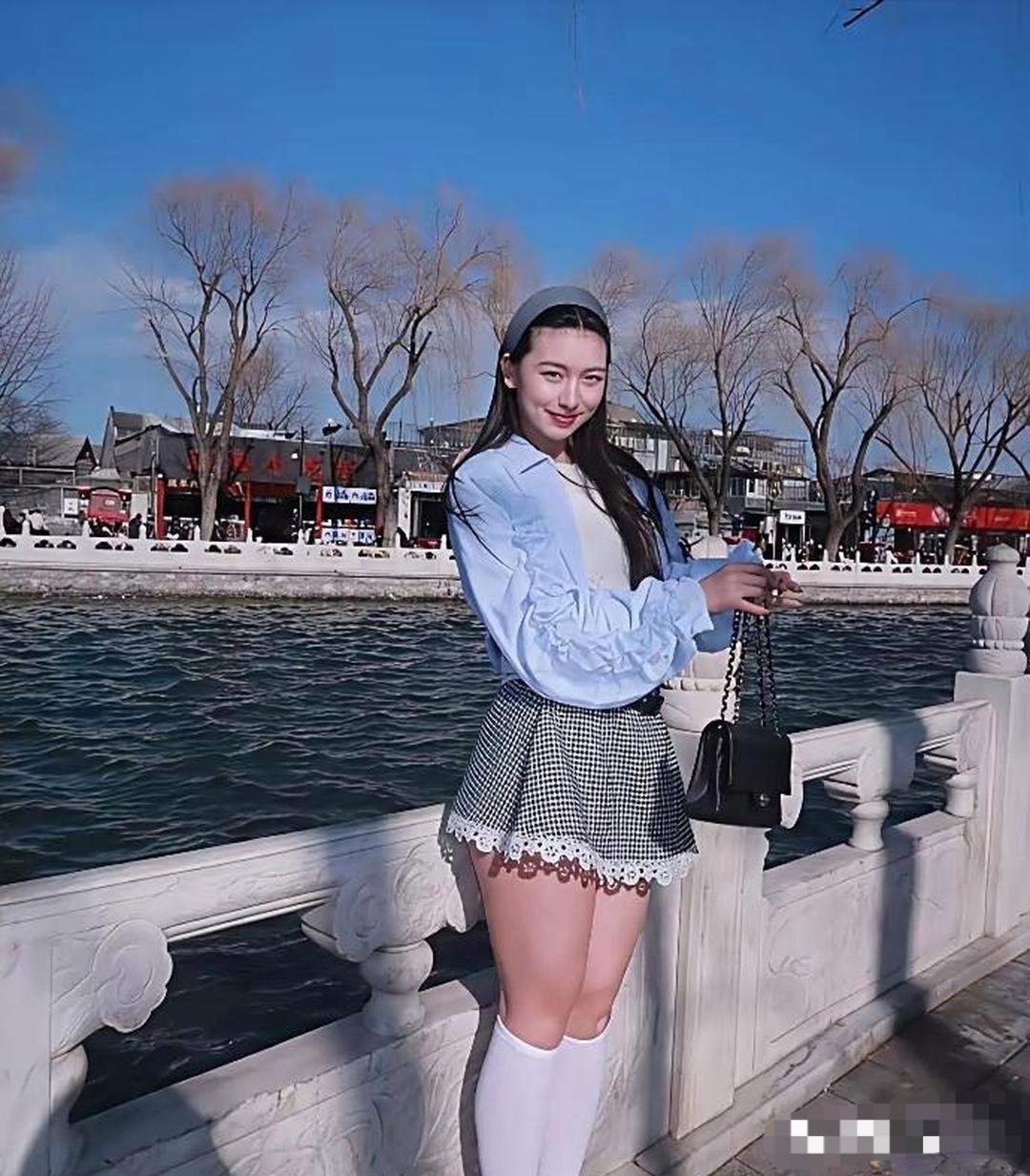 大粗腿就不配穿裙子吗？