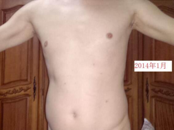 胖小伙还有人鱼线? 健身2年时间成功减掉大肚腩, 瘦下来后变型男