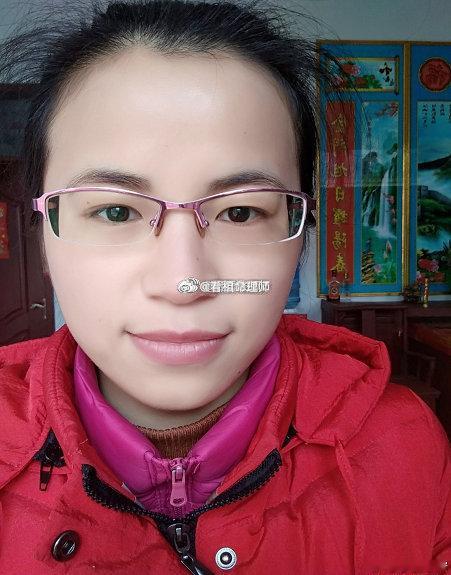 额头突出，发际线杂乱，早年运势一般，家境不是很好，但是为人聪明，且有女强人的架势，考虑事情比较周到，