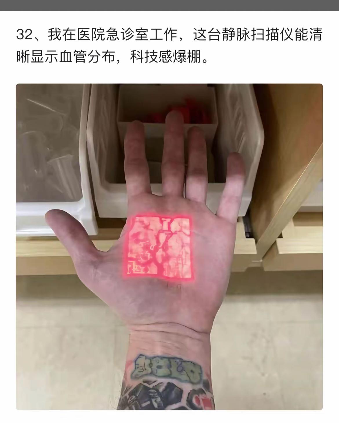 医院急诊室的静脉扫描仪，清晰显示血管分布，震撼科技体验！🔥💉🏥