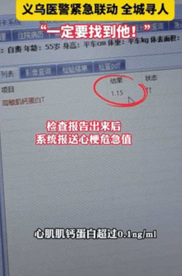 “福大命大！”浙江义乌，57岁大叔胸闷去医院检查，等不及结果就走了，不料医生一看