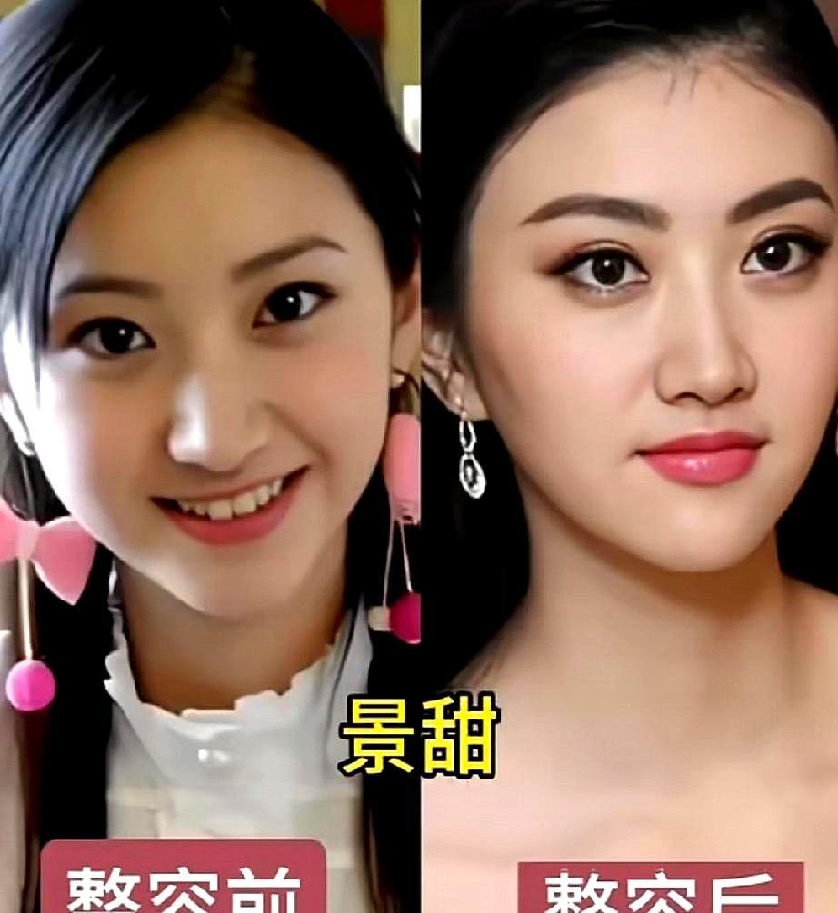 就因为前男友一句“你不够漂亮”，她亲手断送了演艺路。张檬本来灵气十足，跑去