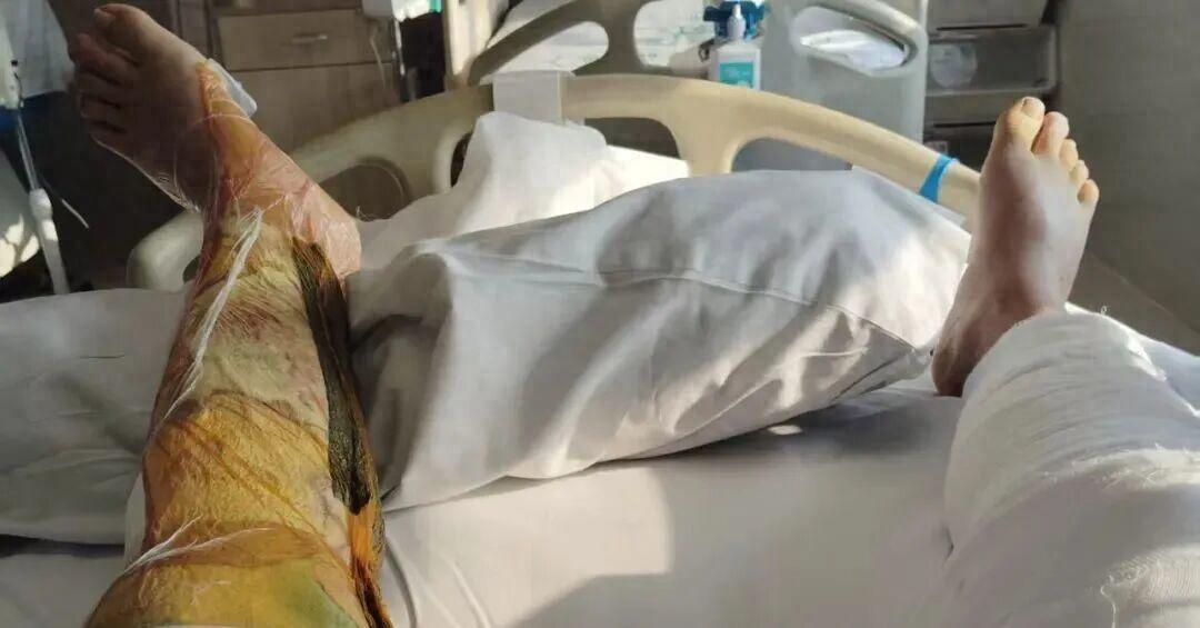 上海闵行，男子自助加油操作失误，汽油泼到裤子上，他压根没放在心上，踩油门直接开车