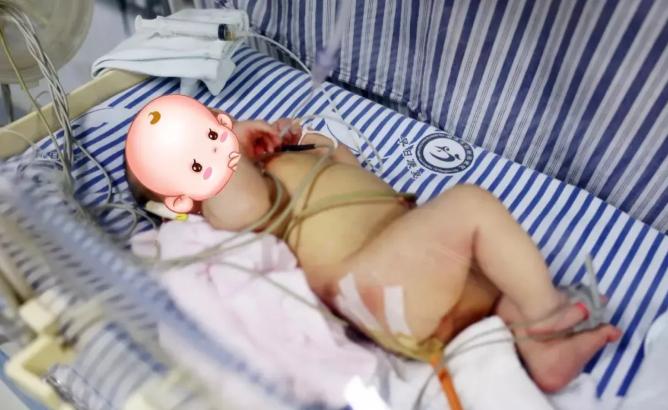 29岁产妇顺产下足月男婴，全家还没来得及高兴，接产医生一翻裤裆当场愣住：孩子屁股
