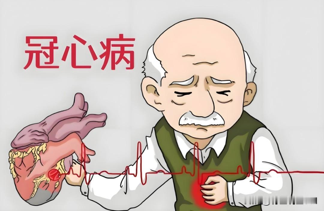护心中成药别乱囤！6种常用药按“心脏问题”选，心肌缺血、心律失常、心衰各有侧重