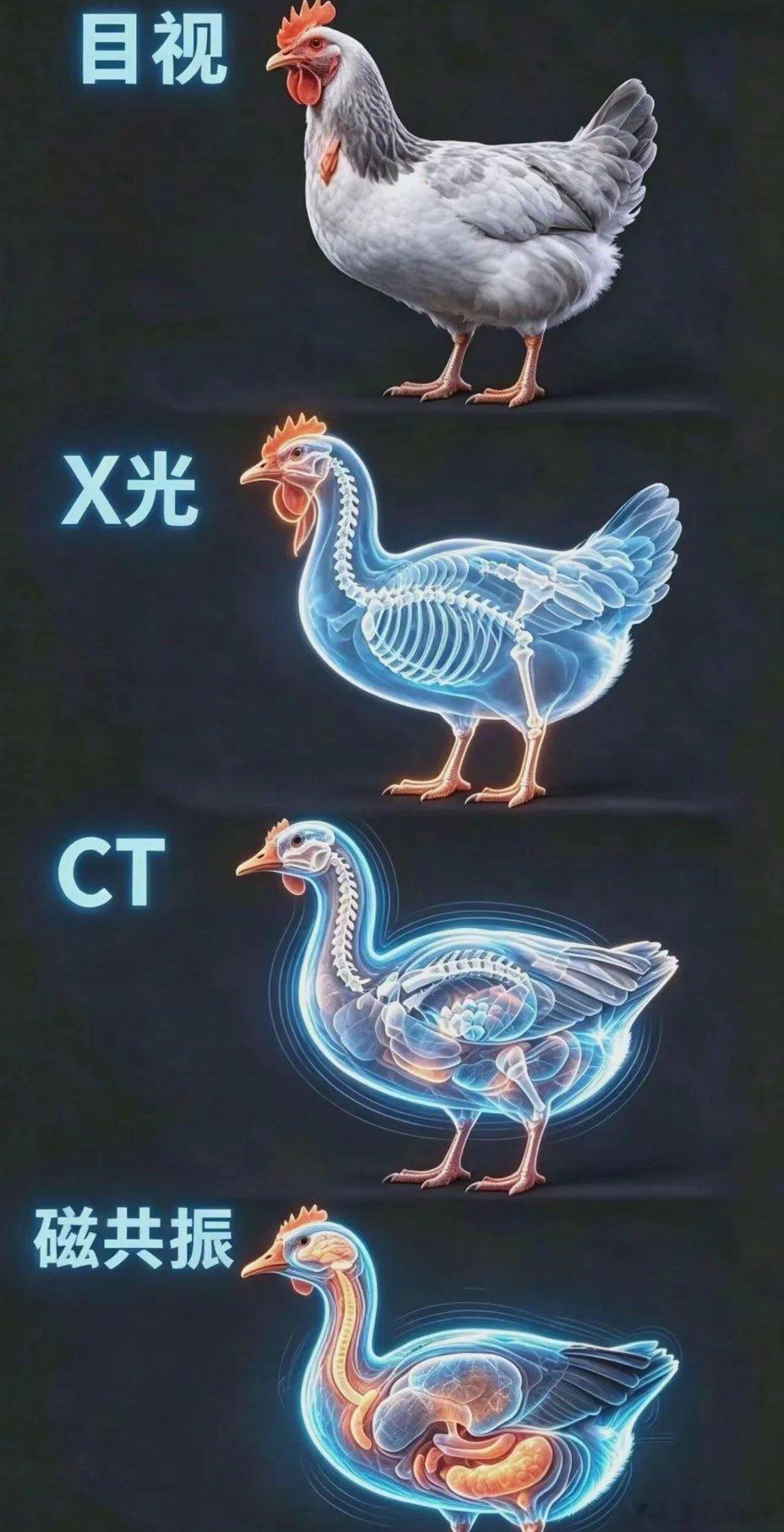直观的感受到磁共振的厉害之处​​​