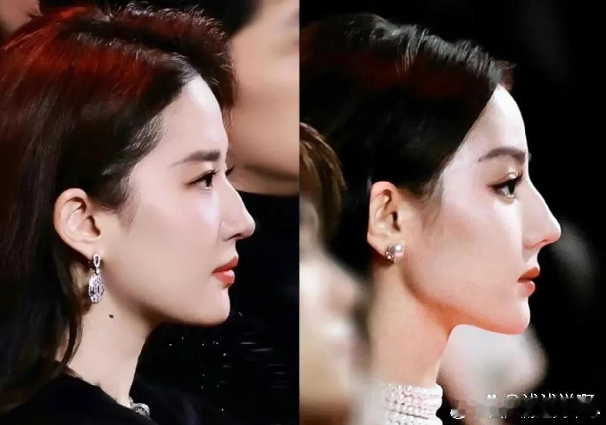 驼峰鼻的天花板，哪个更符合你的审美呢？