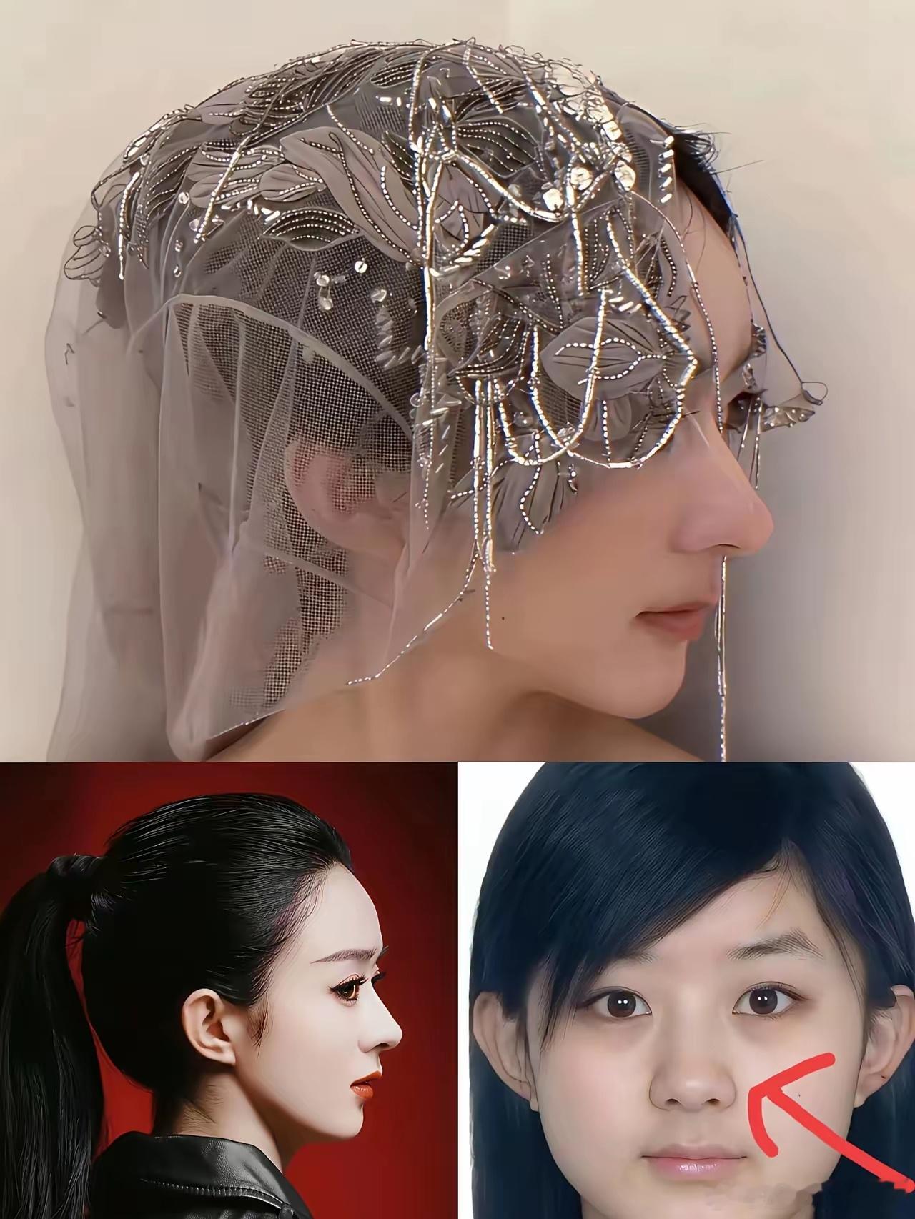 有没有发现赵丽颖真的太不对劲了那就是，她明明以前不长这样啊，尤其是鼻子看起来过于