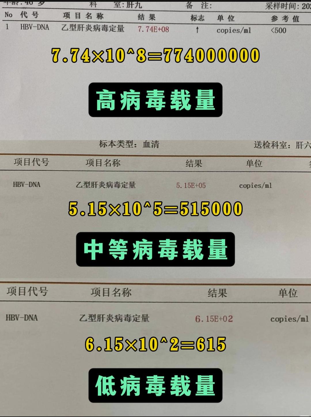 ①高病毒载量：大于10的6次方，这意味着血液中的乙肝病毒数量非常高,传...