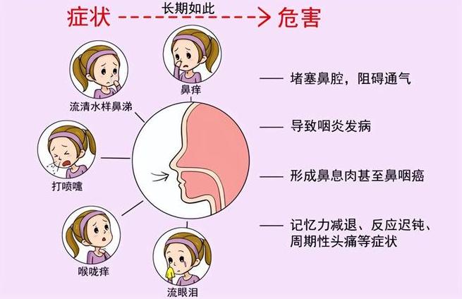 鼻炎其实是肺生病了，以杏仁为引，把肺里的痰浊排出去，鼻炎也就好了鼻炎，其实是肺