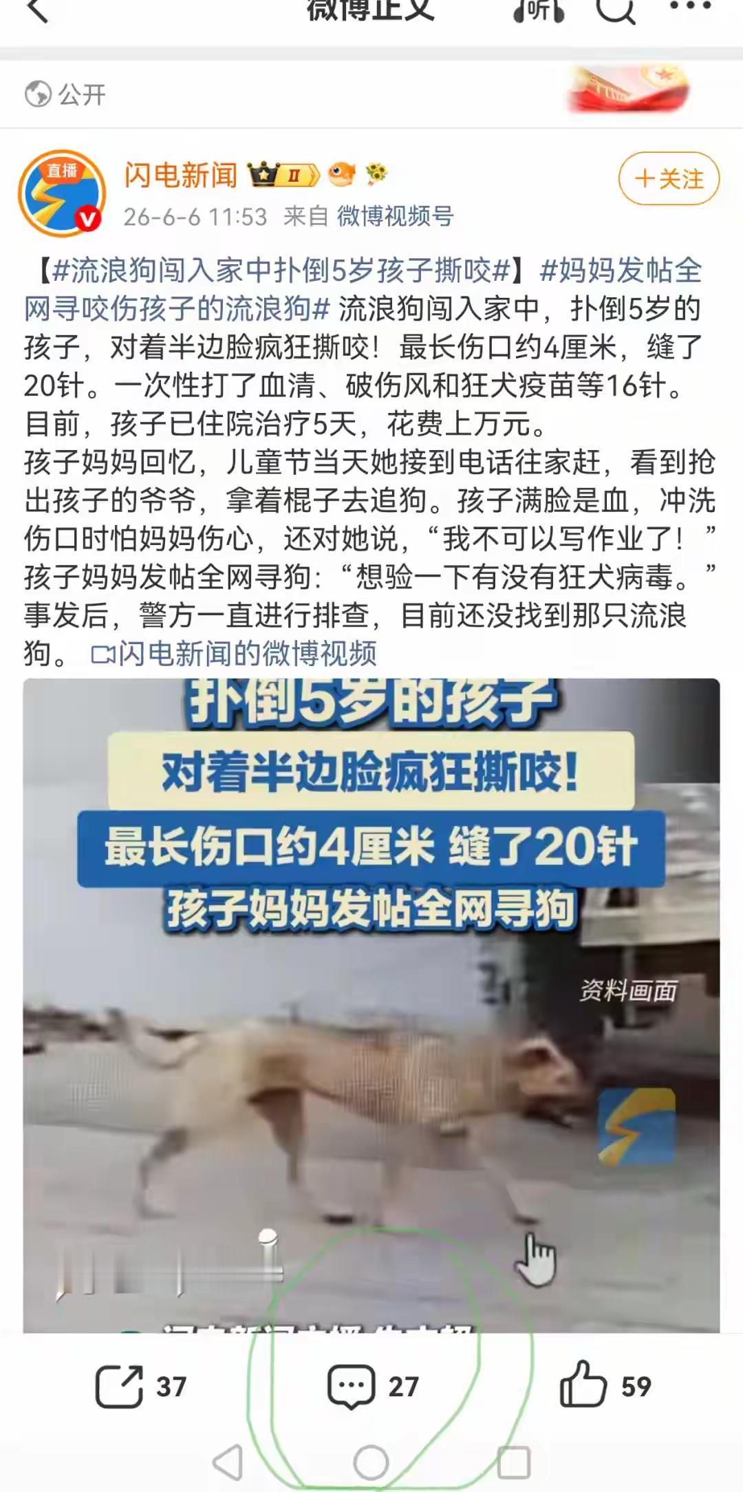 那些说流浪狗可怜、胆小、见人就躲的，出来看看。一只流浪狗冲进人家里，将无辜小孩咬