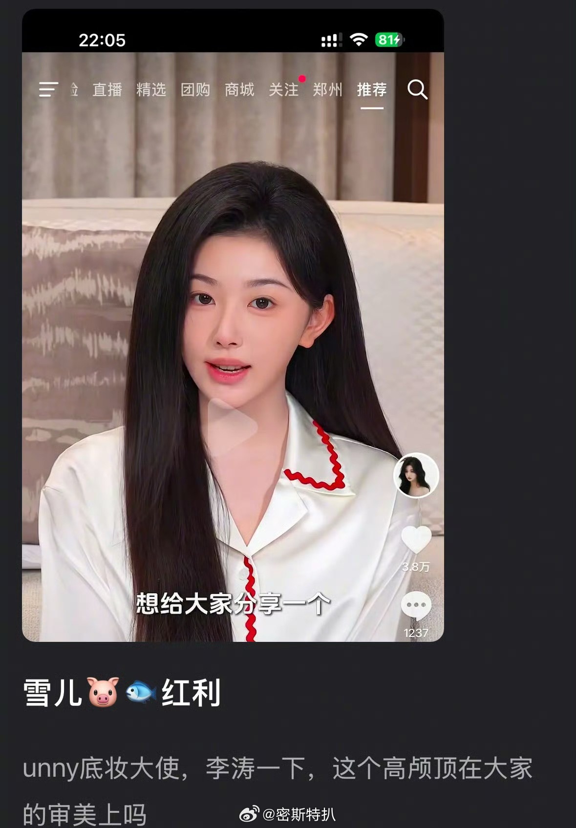 孔雪儿的高颅顶被吐槽审美差了