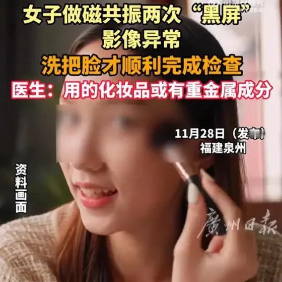 脸上化妆，差点查出个幽灵病！泉州29岁小雅做梦都没想到，一次普通的头晕检查，竟因
