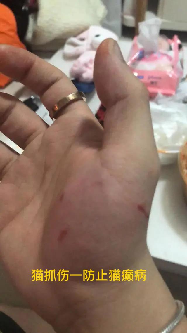 养了2年的猫突然发狂，抓我20多道伤口！它不是变心，是在求救“上一秒还蹭我手