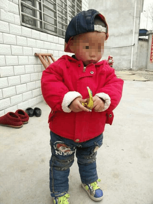 2岁宝宝便秘, 婆婆用肥皂通便, 送医后已错过最佳治疗时间