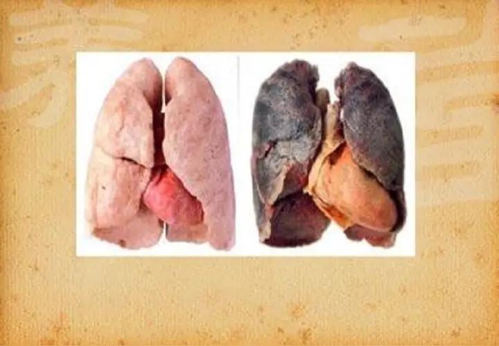 戒烟时你有过哪些身体变化戒烟时，你是否曾在镜子前突然发现，自己似乎在无声中经历