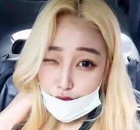 做眼部整形术后整个人看起来和以前大不一样