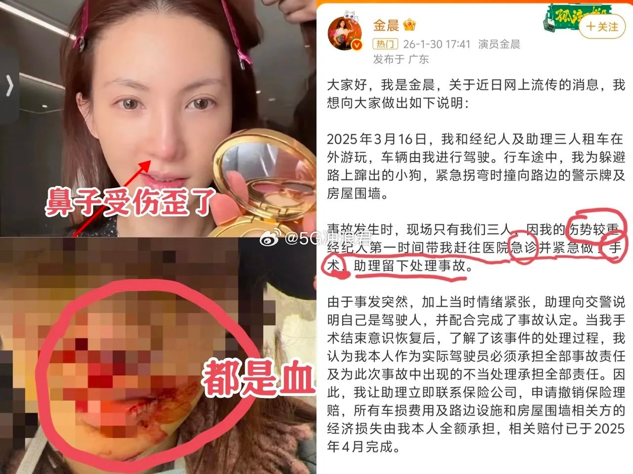 我想过金晨是喝酒了，也怀疑过金晨鼻子撞歪了，但没想到当时情况那么紧急，金晨脸上受