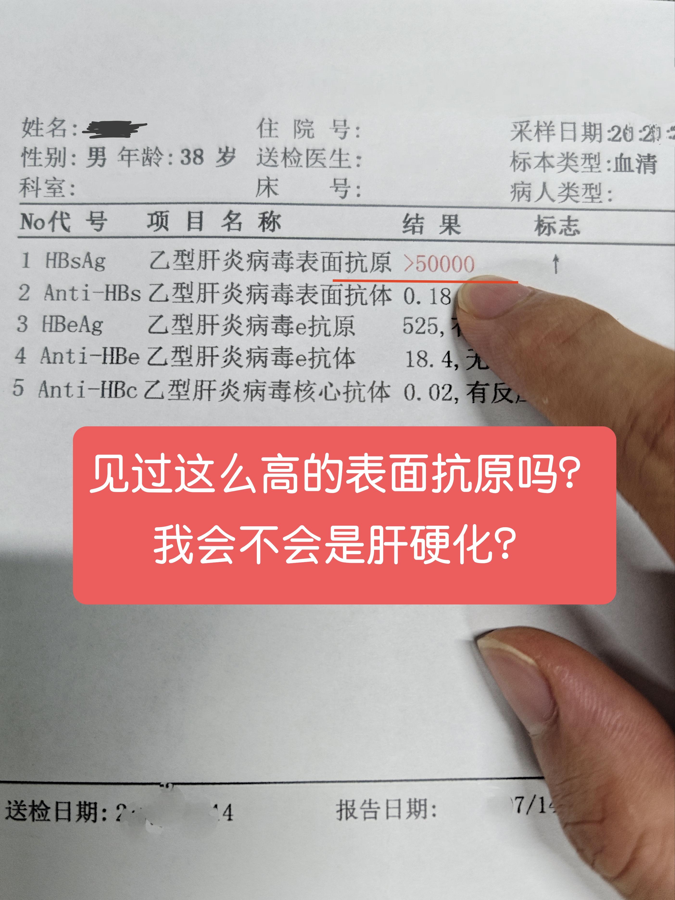 “我今年38岁，体检时发现是乙肝大三阳，表面抗原居然＞5万！我拿到报告...
