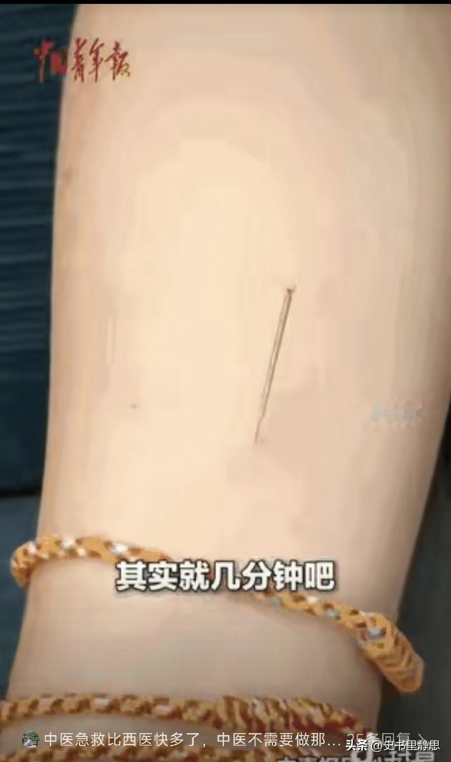 中医太牛了！高铁上，一名男子突然感觉自己快要死了，心慌胸闷，呼吸困难等，周围乘客