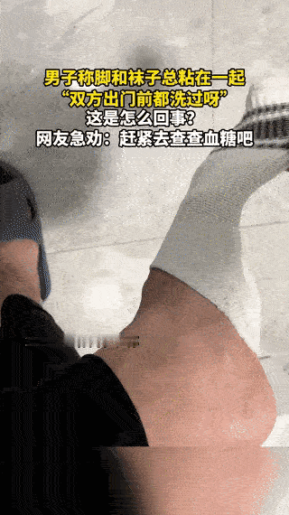 “科学都解释不清了！”2月11日，江苏，一男子脱袜子时，袜子和脚总是粘在一起，起