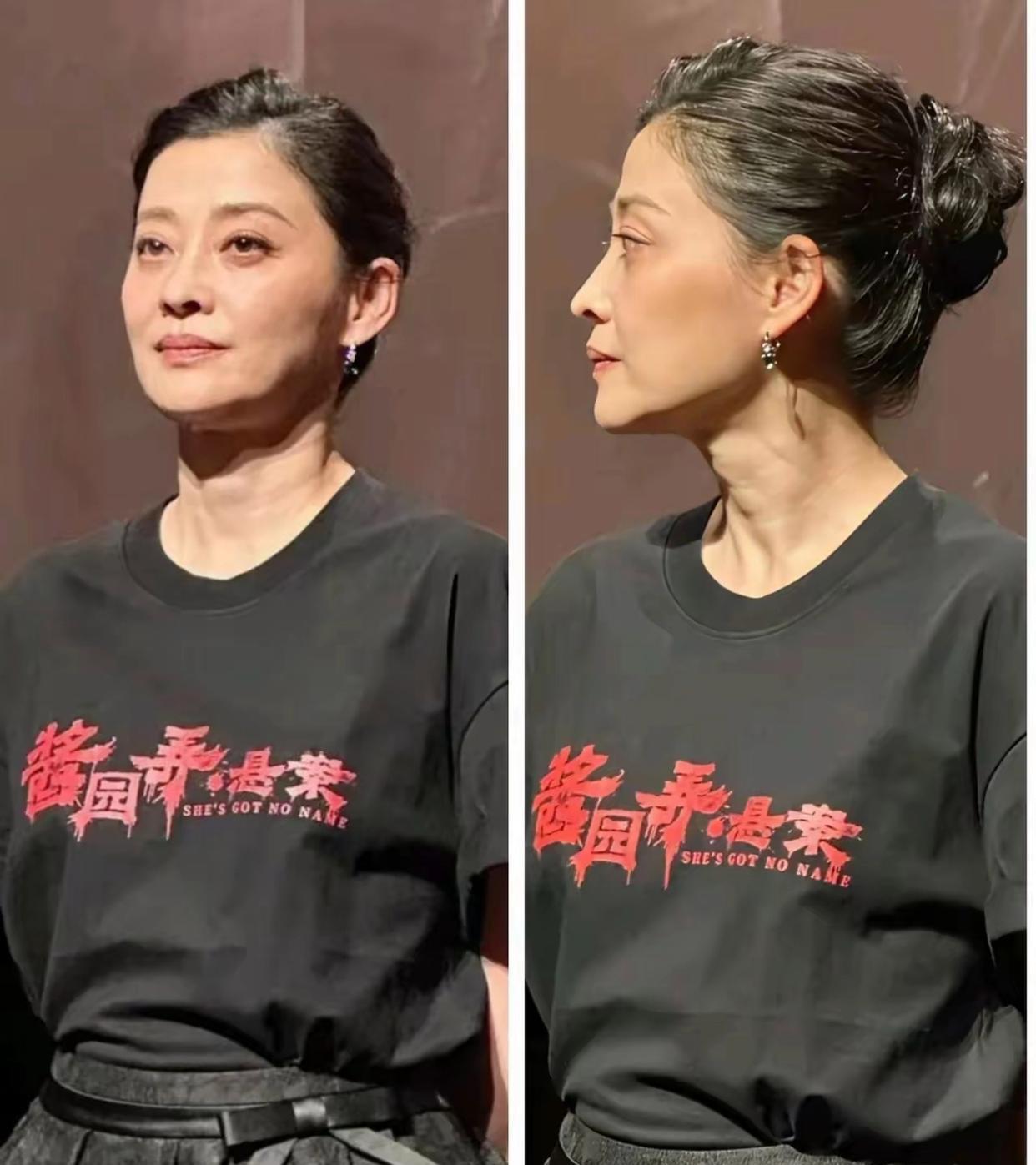梅婷才刚刚50岁，怎么老成这样了，近照满脸沧桑，活动现场脸都垮了，皮肤也没弹性了
