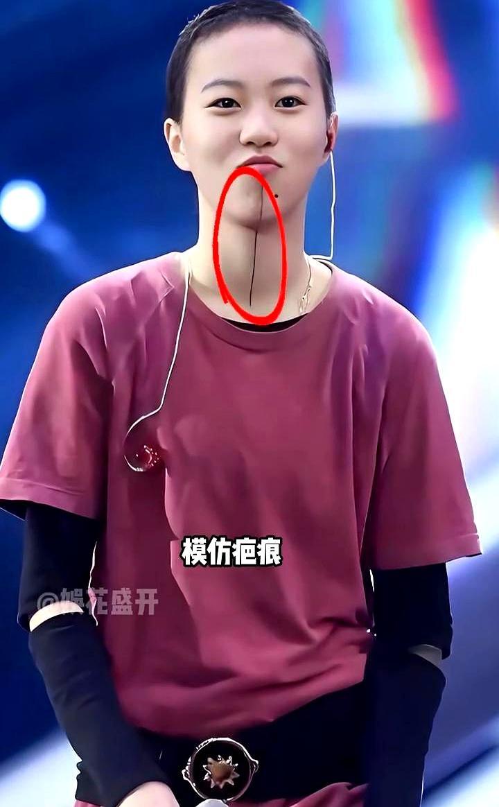 瞒不住了，窦靖童下巴那条线根本没消失，真相让所有人沉默。那不是彩绘，是纹身