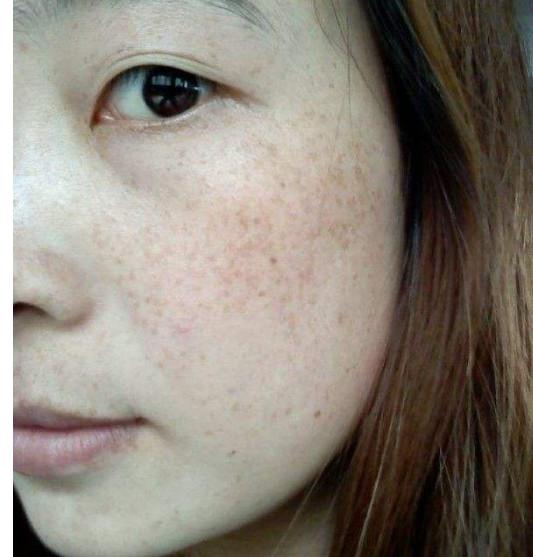 红糖是个宝, 睡前用它敷面膜, 半个月消除顽固性斑点