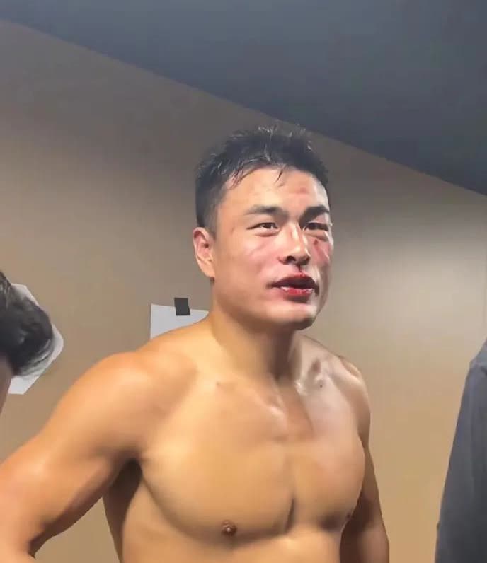 上海站，三个受伤最严重的运动员怎么样了，据了解，张名扬受伤严重需要进行手术。尹帅