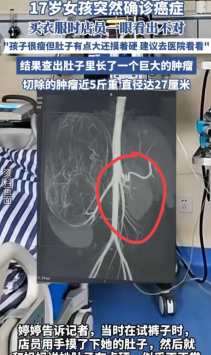 2025年6月，广东17岁女孩和妈妈一起逛街买衣服，在试裤子的时候，老板娘发觉女