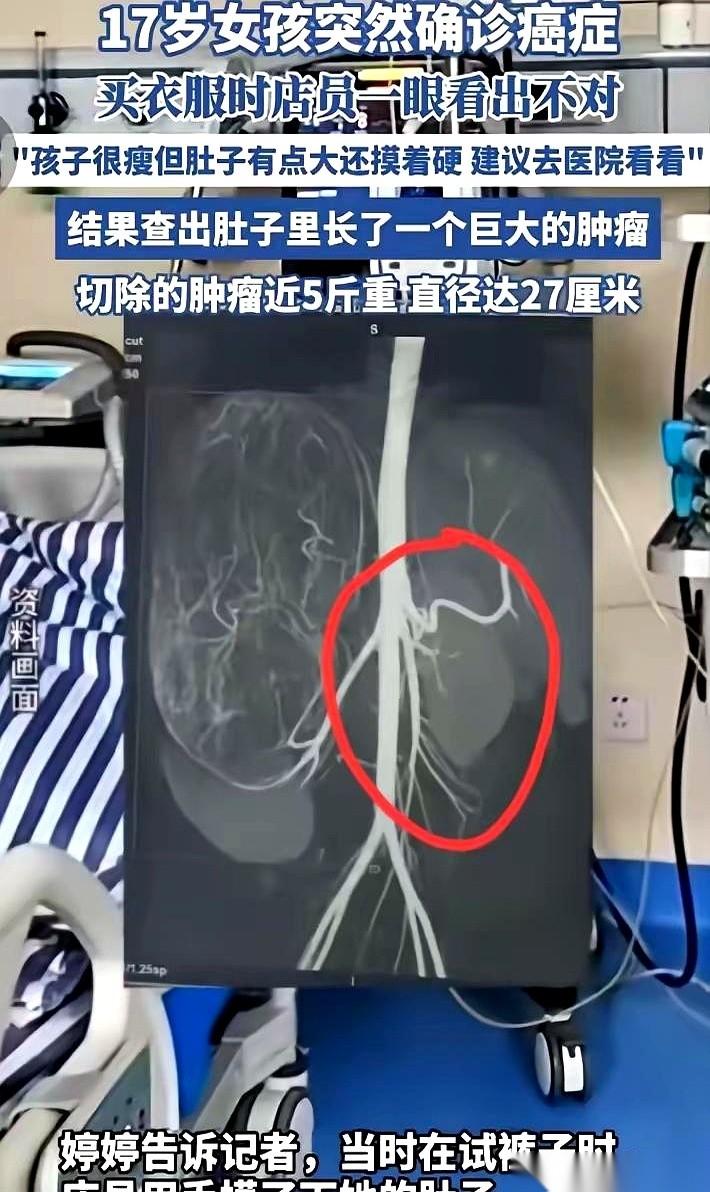 广东一家服装店，店员伸手给一个17岁女孩量腰围，软尺刚贴上去，她的手就像触电一样