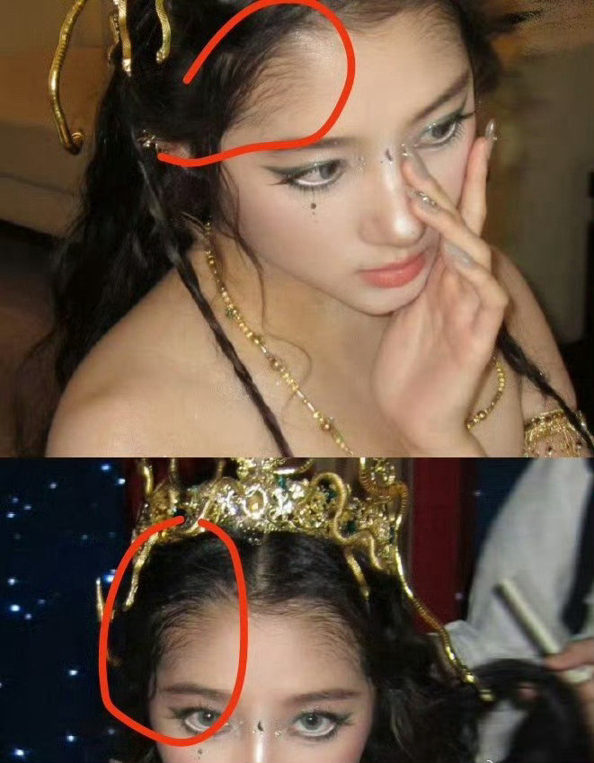 这种额头适合演笨蛋美人​​​
