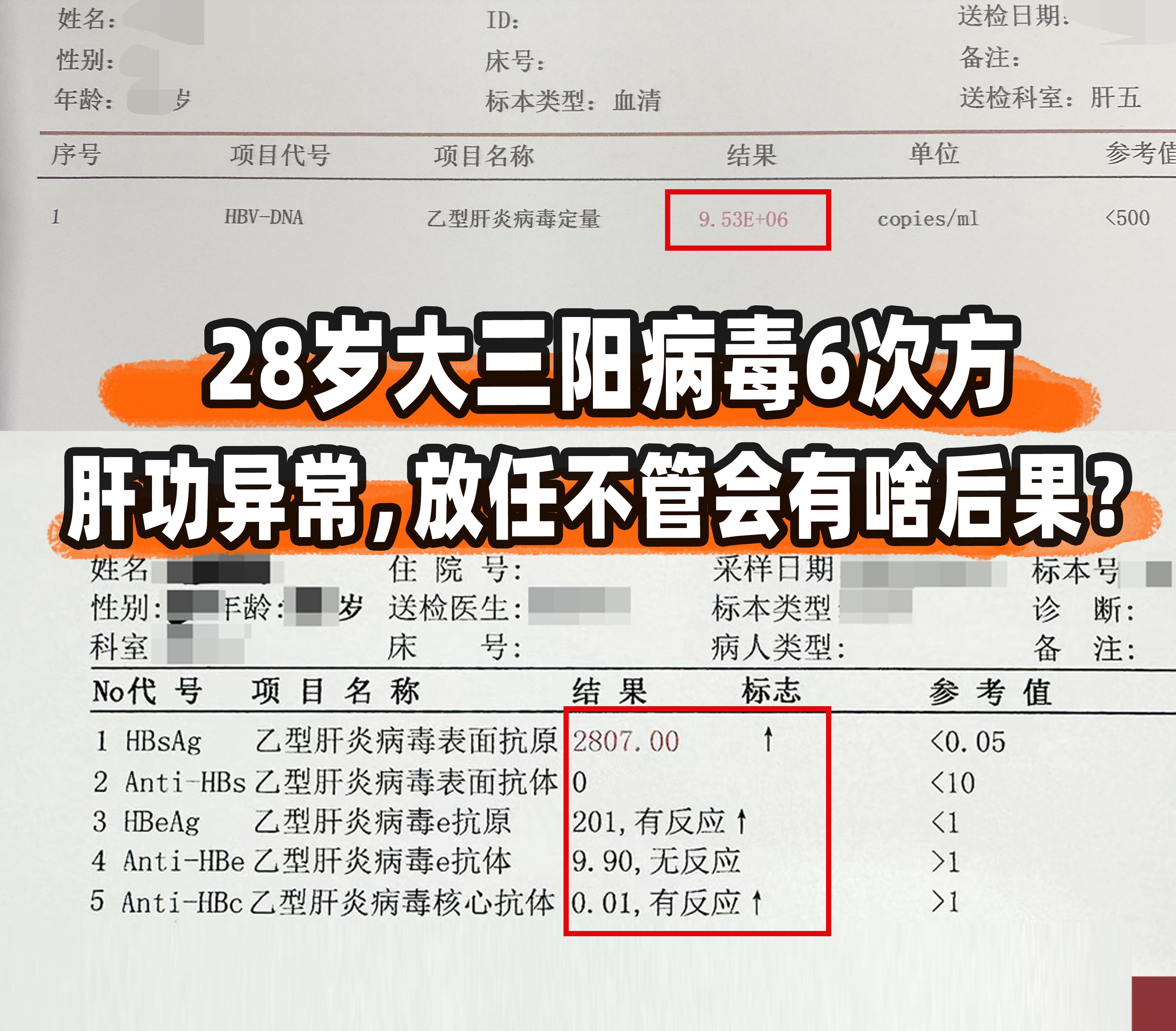 28岁大三阳病毒6次方，放任不管会有啥后果？ ①大三阳传染性高，病毒复...