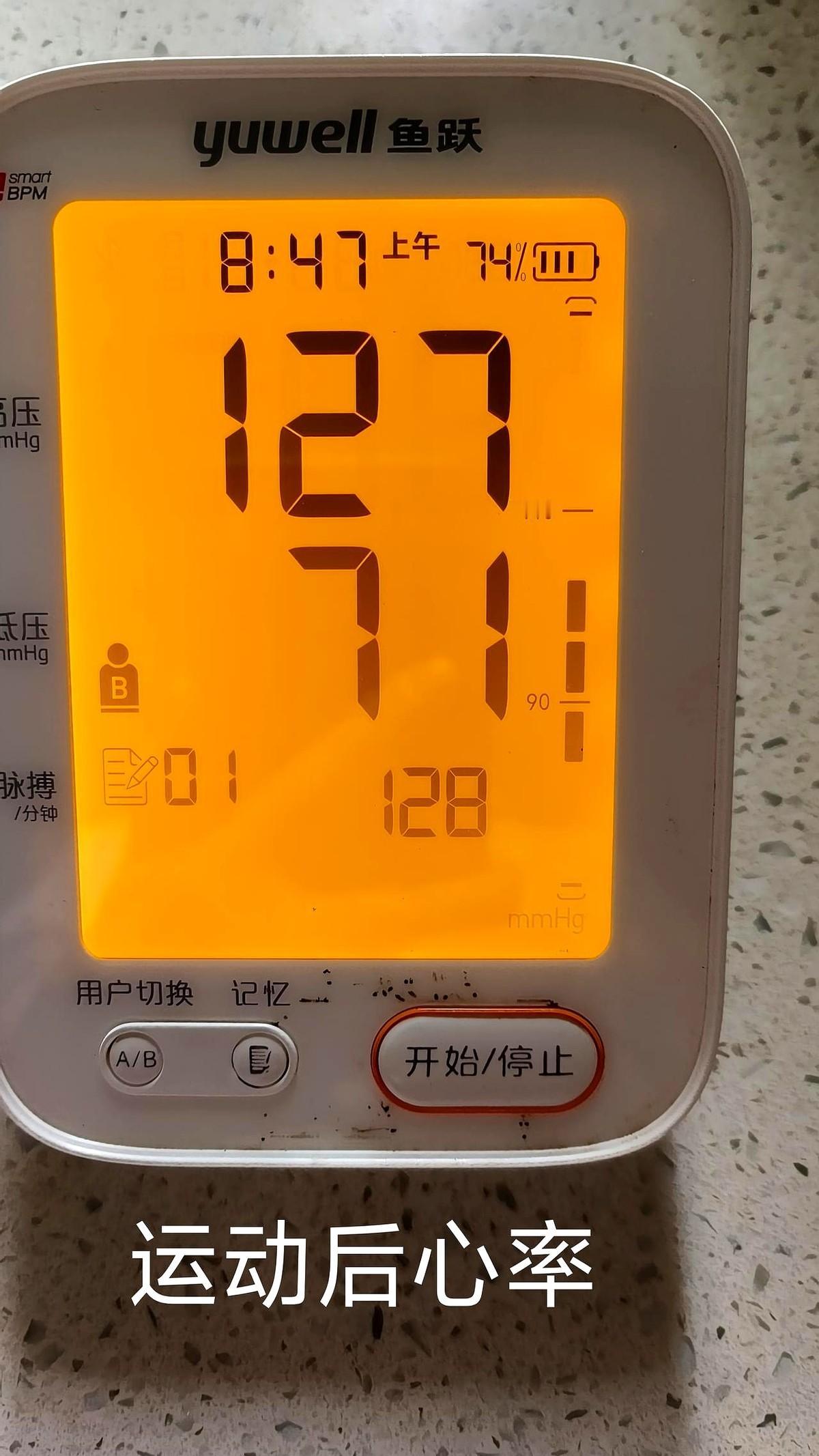 “骨头快报警了,还跳得动操吗?”体检报告上-1.8的骨密度,把58岁的李阿姨