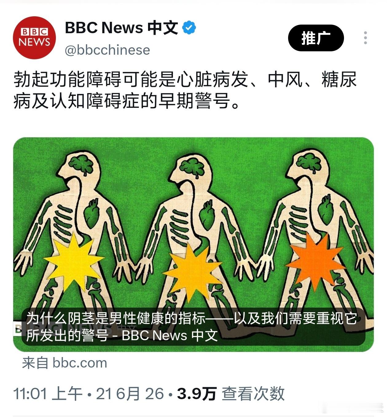 BBC：勃起功能障碍可能是心脏病发、中风、糖尿病及认知障碍症的早期警号新娘回应伴