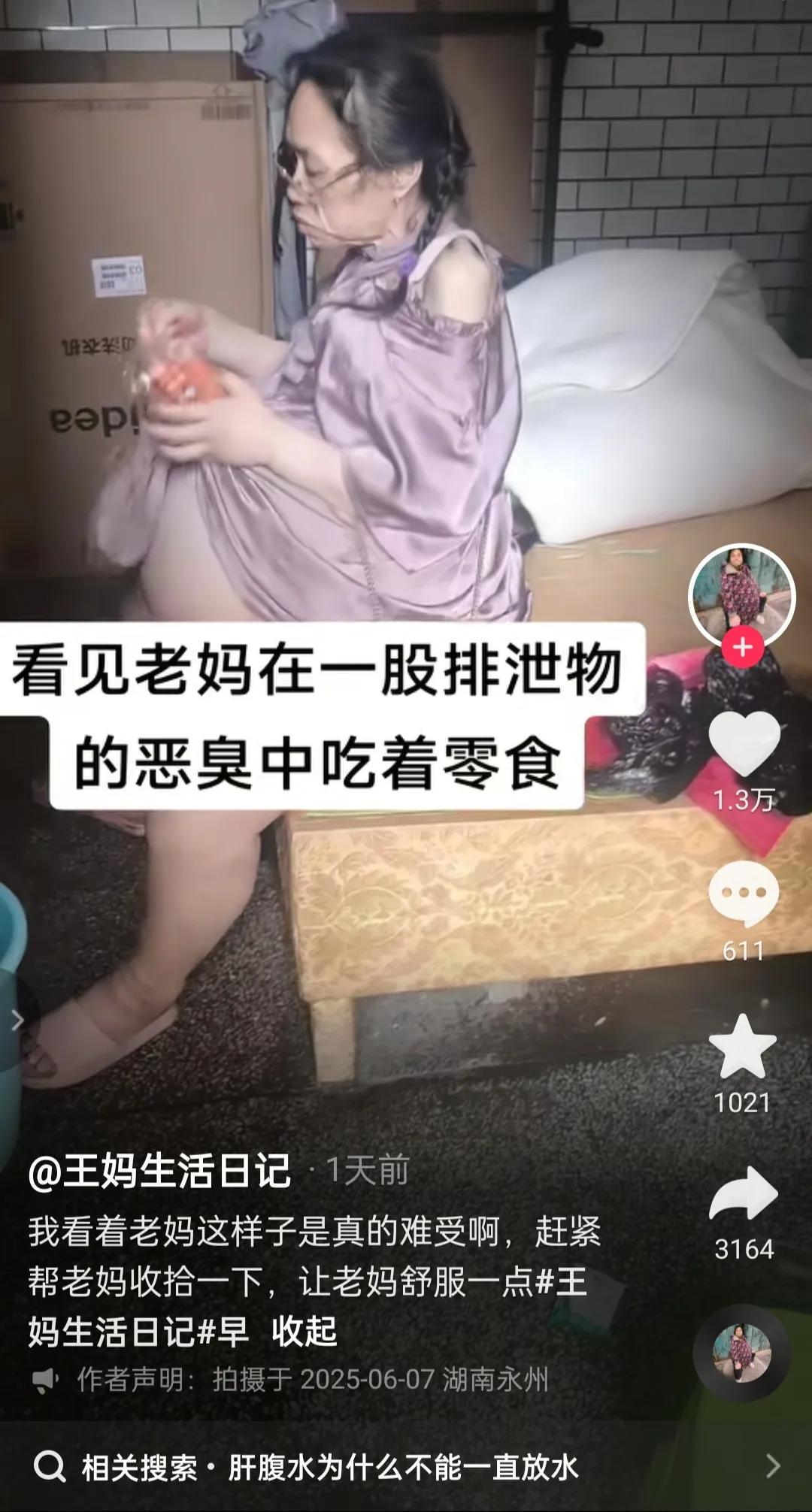 老年人患上肝腹水这个病，可以说是既痛苦又没尊严。6月8日，湖南永州一中年女性患病