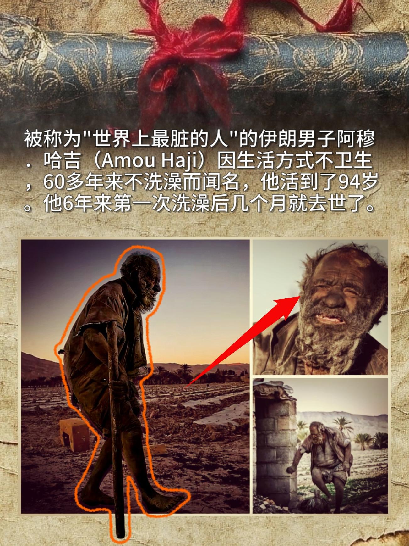 被称为"世界上最脏的人"的伊朗男子阿穆．哈吉Amou Haji因生活方...