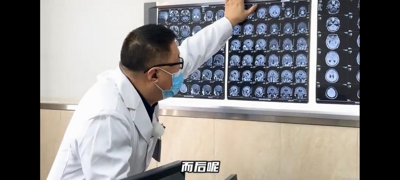 母细胞胶质瘤三个月自我缓解小了许多。男人拿着先后的片子去找现在的医生。医生