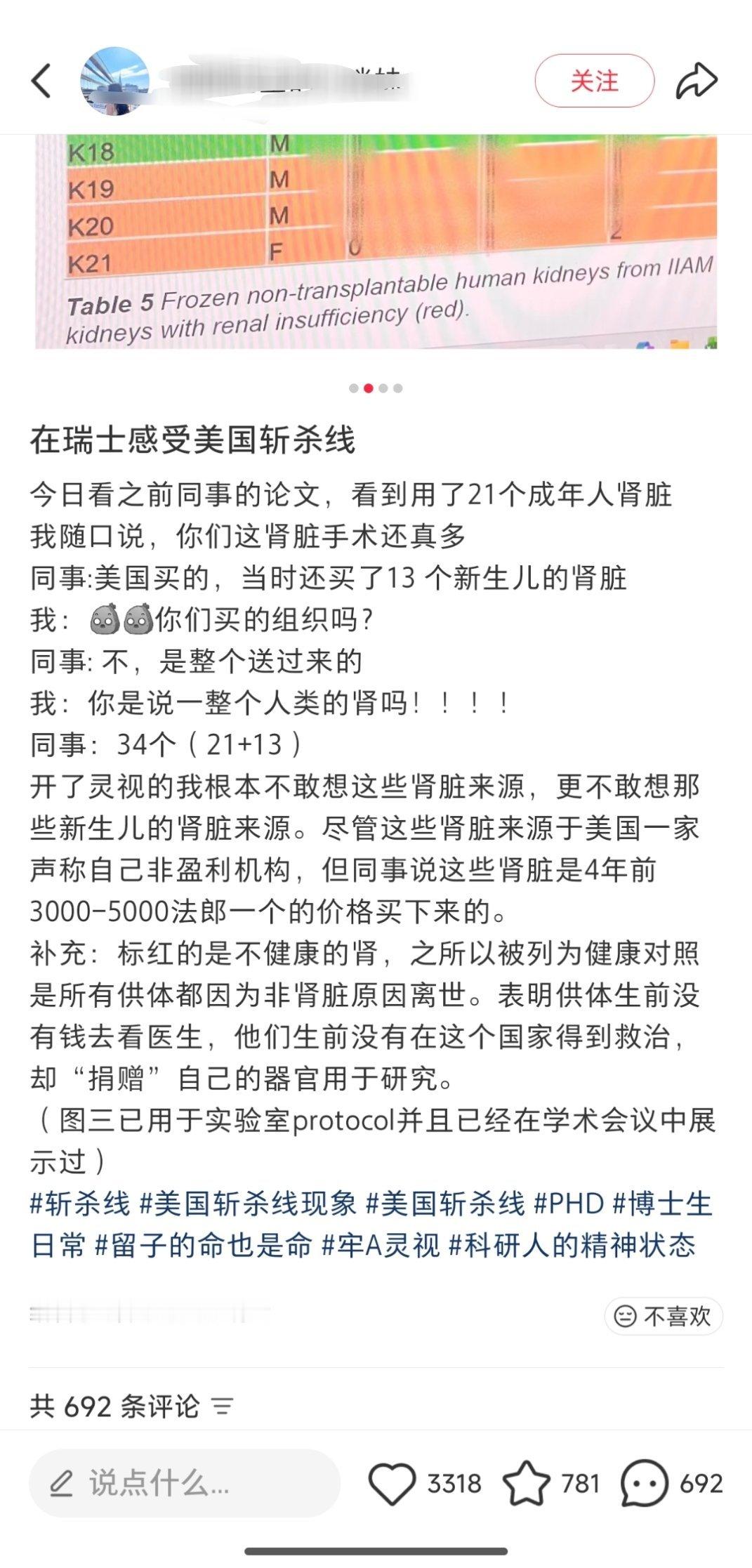 在瑞士感受美国斩杀线，一次从美国买了34个人的肾，其中还有13个是新生儿。