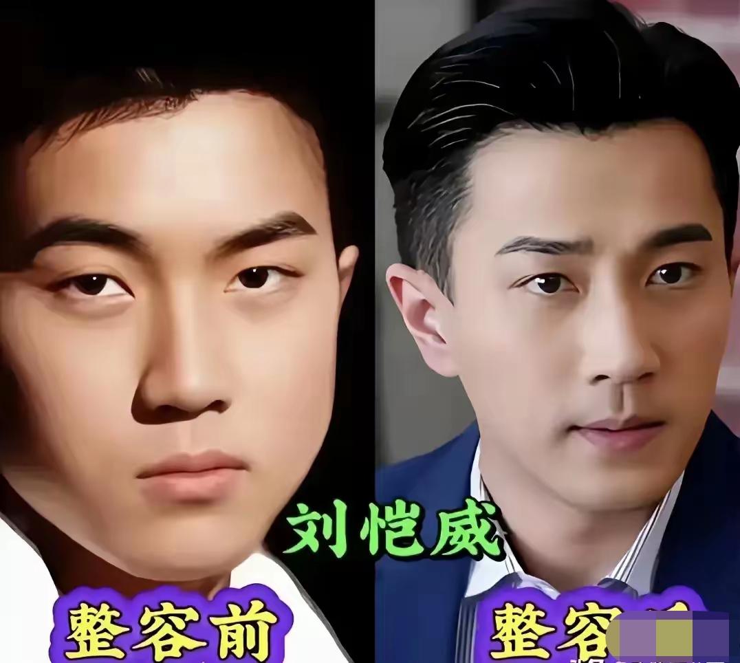 不必总拿明星微调这件事随意评判，身处演艺圈，打理外表也是谋生的无奈选择。如今医美
