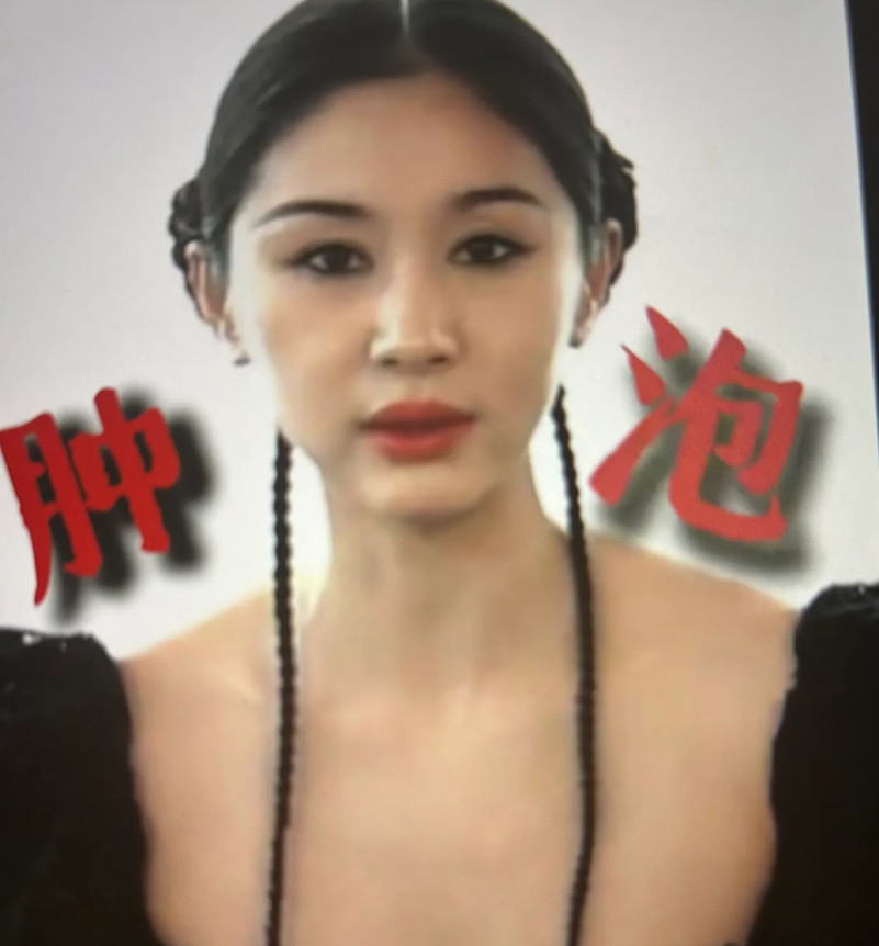 王子文花几百万做了轮廓固定，可这东西一旦疏于保养，脸马上又肿又泡，像发面馒头。提