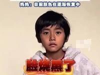 吓哭家长！男孩发烧10多小时，退烧后脸黑得像“包公”，医生警告：这不是小问题！