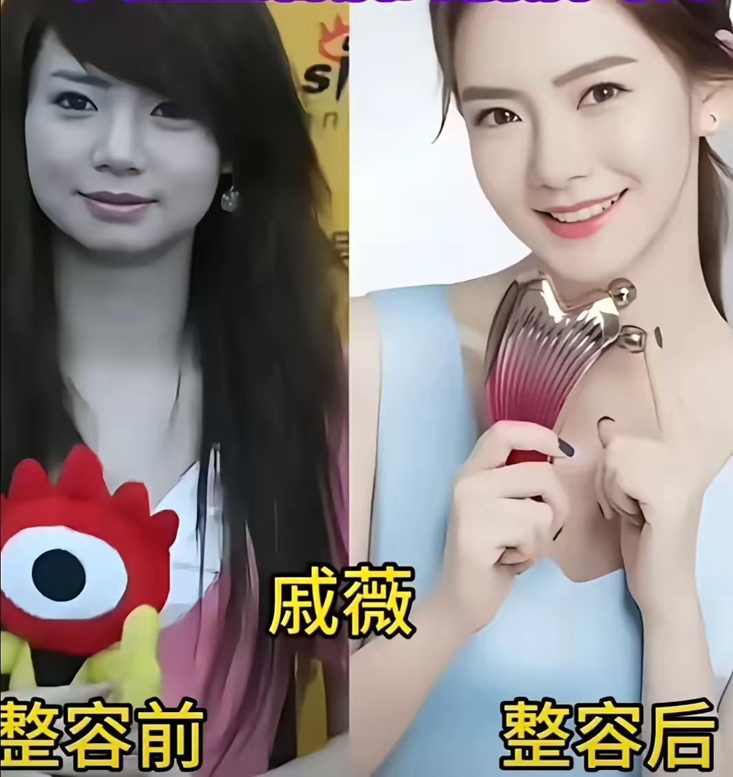 戚薇微调后更精致了宋雨琦微调后更精致了爱美之心人皆有之，两位女明星微调后更加