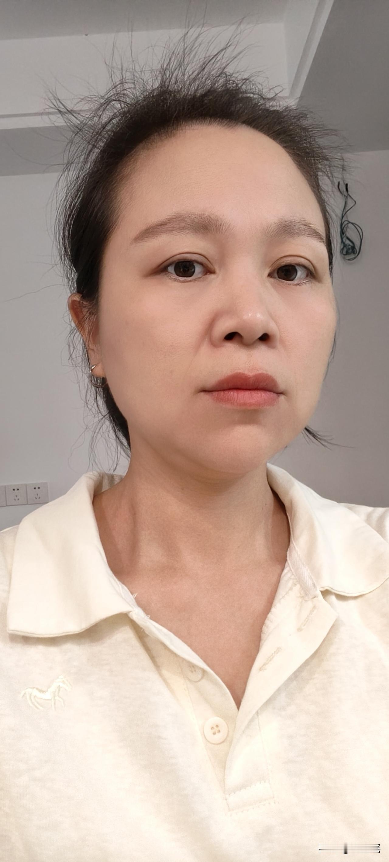 一位专业宫颈癌的主任医生说，现在感染了HPV16阳，得了宫颈癌不可怕，不用自己吓